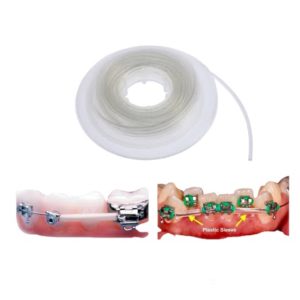 Archwire Sleeves - Image 1
