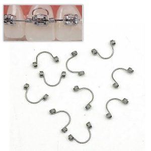Ortho Torque spring 17x25 - Image 1