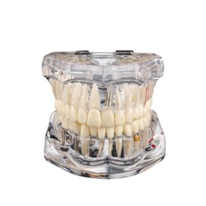 Transparent Cast - Image 1